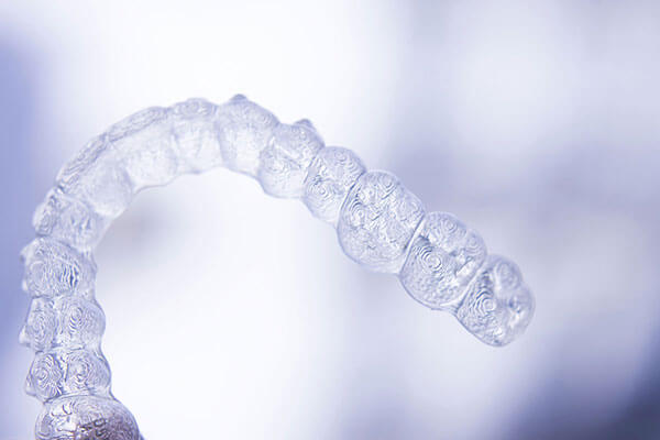 Clear Aligners